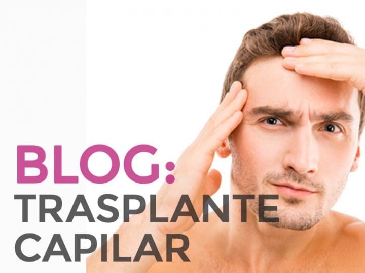 ¿Se puede caer el pelo después de un trasplante capilar?