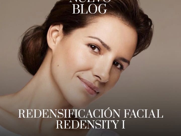 Redensificación facial con Redensity I
